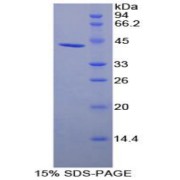 SDS-PAGE analysis of recombinant Human PLAUR Protein.