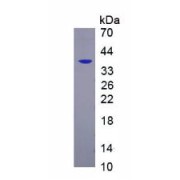 SDS-PAGE analysis of Mouse PDGFRb Protein.