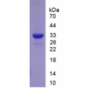 SDS-PAGE analysis of recombinant Human CD36 Protein.