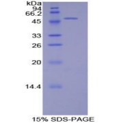 SDS-PAGE analysis of Rat PECAM1 Protein.