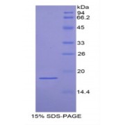 SDS-PAGE analysis of recombinant Human Podocin Protein.