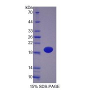 SDS-PAGE analysis of Rat Podocin Protein.