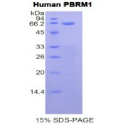 SDS-PAGE analysis of Human Polybromo 1 Protein.