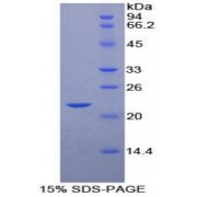 SDS-PAGE analysis of Human POTEG Protein.