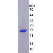 SDS-PAGE analysis of Human PRDM1 Protein.