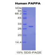 SDS-PAGE analysis of Human PAPPA Protein.
