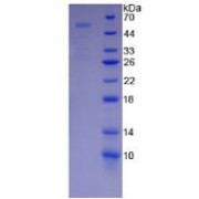 abx068655