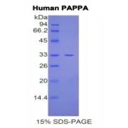 abx068657
