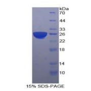 abx068658