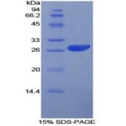SDS-PAGE analysis of Human Prion Protein.