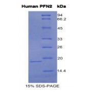 SDS-PAGE analysis of Human Profilin 2 Protein.