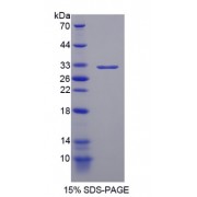 SDS-PAGE analysis of recombinant Human PML Protein.
