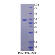 SDS-PAGE analysis of Human PCSK9 Protein.