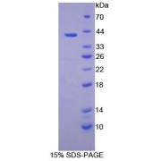 SDS-PAGE analysis of Human PSMD7 Protein.