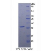 SDS-PAGE analysis of recombinant Human CD59 Protein.