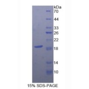 abx068725