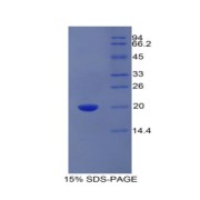 SDS-PAGE analysis of Human PROCR Protein.