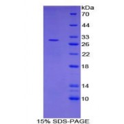 SDS-PAGE analysis of Human PIAS1 Protein.