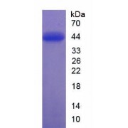 SDS-PAGE analysis of Human Protein Kinase B alpha Protein.