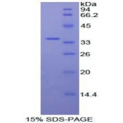 SDS-PAGE analysis of Human Protein Kinase B beta Protein.