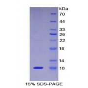 SDS-PAGE analysis of Human PKIa Protein.