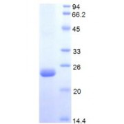 SDS-PAGE analysis of Human Protein S Protein.