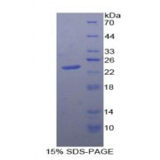 SDS-PAGE analysis of recombinant Human PTPRN Protein.