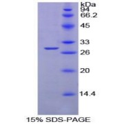 SDS-PAGE analysis of recombinant Mouse Protein Tyrosine Phosphatase Receptor Type S (PTPRS) Protein.