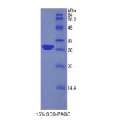 SDS-PAGE analysis of Human Protein Zero, Myelin Protein.