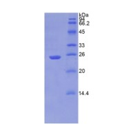 SDS-PAGE analysis of Human PSA Protein.