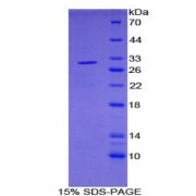 SDS-PAGE analysis of Human PDP Protein.