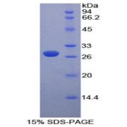 SDS-PAGE analysis of Mouse PK Protein.