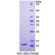 SDS-PAGE analysis of Human PKM Protein.