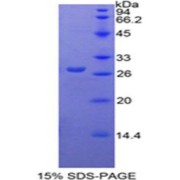 SDS-PAGE analysis of Rat PKM2 Protein.