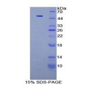 SDS-PAGE analysis of Human PKM2 Protein.