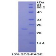 SDS-PAGE analysis of Human RAD54 Like Protein 2 Protein.
