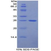 SDS-PAGE analysis of recombinant Human FcgRI Protein.