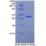 SDS-PAGE analysis of Human FcgRII Protein.