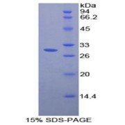 SDS-PAGE analysis of Rat FcgRII Protein.