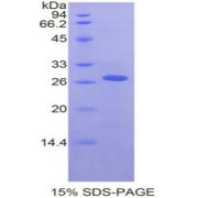 SDS-PAGE analysis of recombinant Rat RIPK3 Protein.