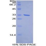 SDS-PAGE analysis of Human ROR1 Protein.