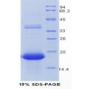 SDS-PAGE analysis of Mouse REG3G Protein.