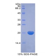 SDS-PAGE analysis of recombinant Human RXFP1 Protein.