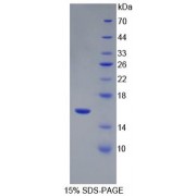 SDS-PAGE analysis of recombinant Human Renin (REN) Protein.