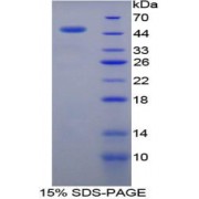 SDS-PAGE analysis of Human RB1 Protein.