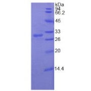 SDS-PAGE analysis of recombinant Human RIG1 Protein.