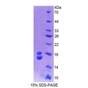 SDS-PAGE analysis of Cow RBP1 Protein.