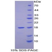 SDS-PAGE analysis of Human RBP2 Protein.