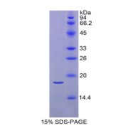 SDS-PAGE analysis of Mouse RBP2 Protein.