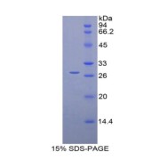 SDS-PAGE analysis of Rat RBP3 Protein.